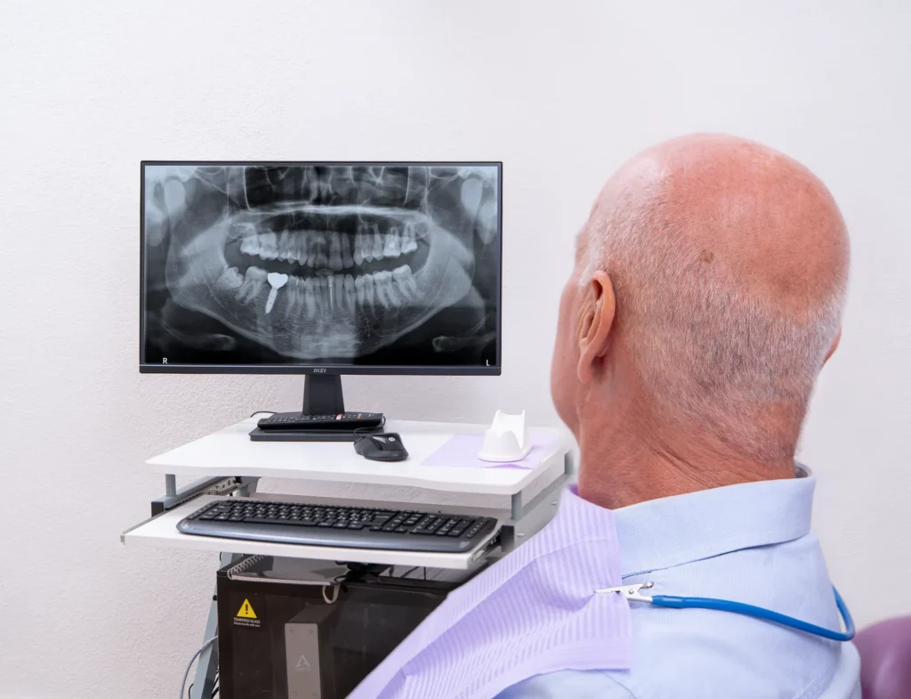 Un paziente osserva la sua radiografia panoramica con l'impianto sul monitor dello studio