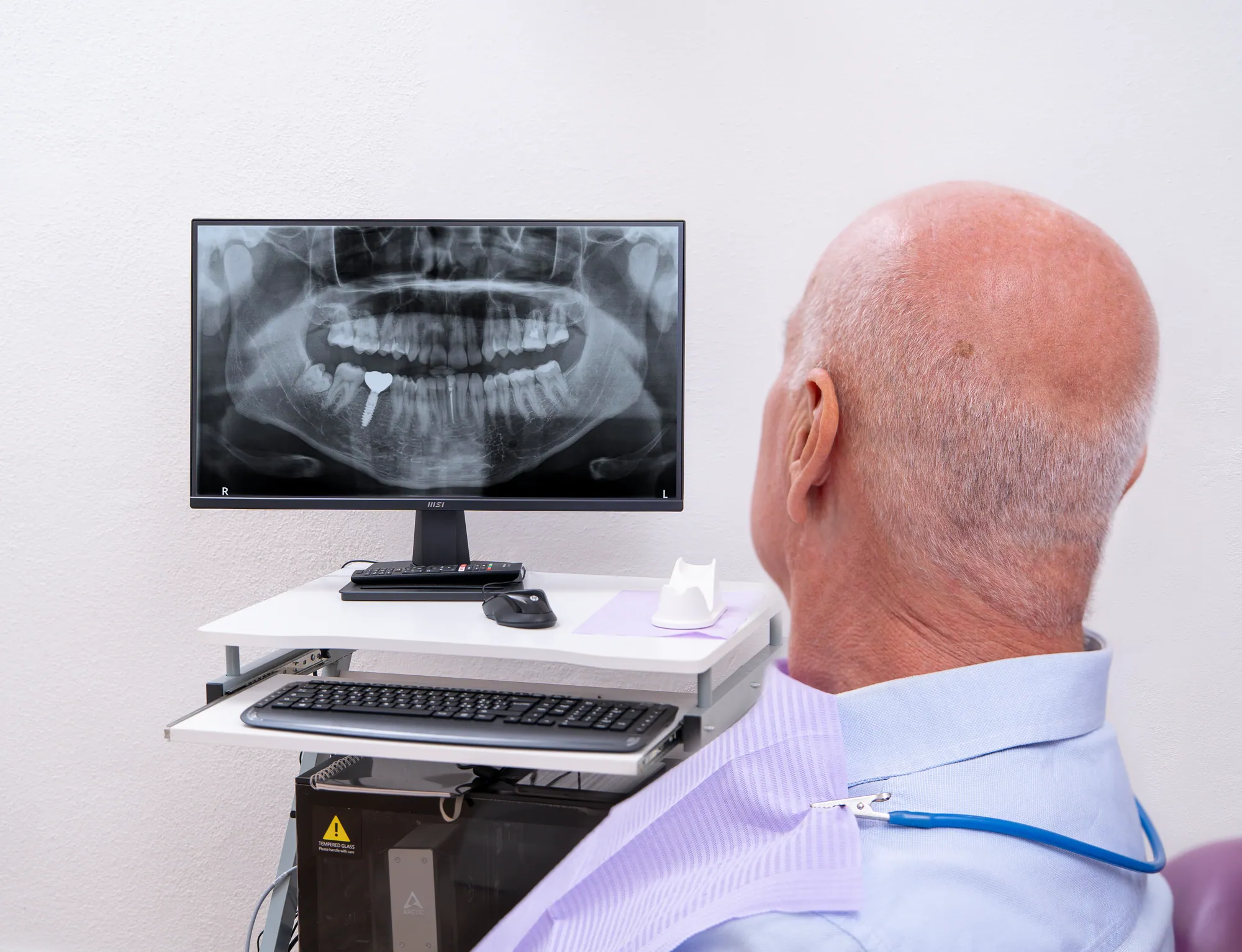 Un paziente osserva la sua radiografia panoramica con l'impianto sul monitor dello studio