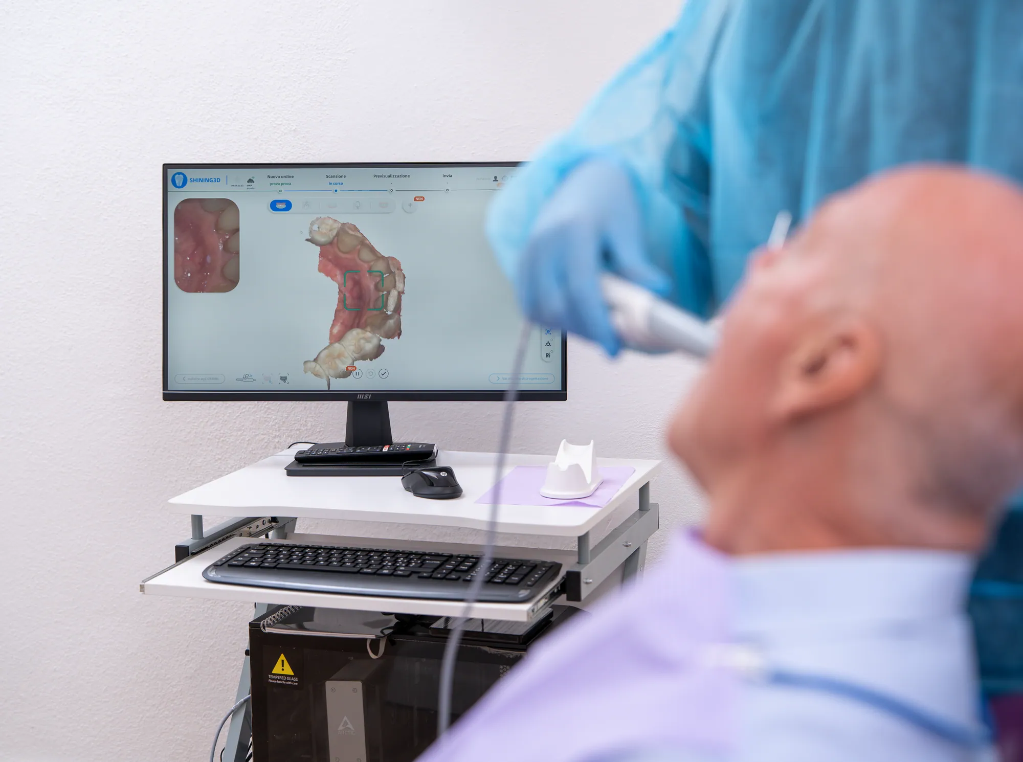 Un paziente in poltrona durante la scansione intraorale, con il modello 3D sul monitor